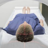 MRI Scan Stock Photo | Brain Injury Cases | Nashville